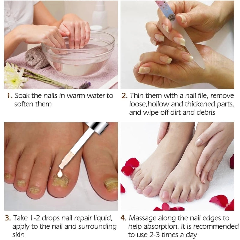 Nail Treatments Essence Feet Care Serum Nails Fungus Foot Toe Fungal Removal Gel Anti Infection Paronychia Onychomycosis Repair